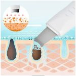 اتو صورت اولتراسونیک Shovel Skin Machine